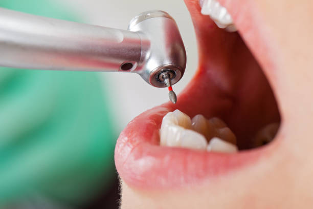 Best Emergency Dental Surgery in Shady Spring, WV